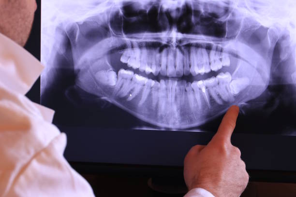 Best Emergency Dental Surgery in Gardiner, ME