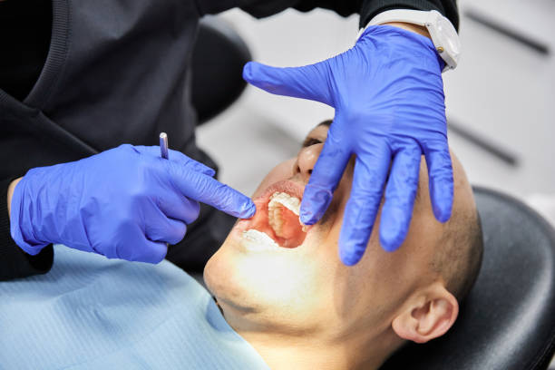 Best Emergency Tooth Extraction in Gardiner, ME